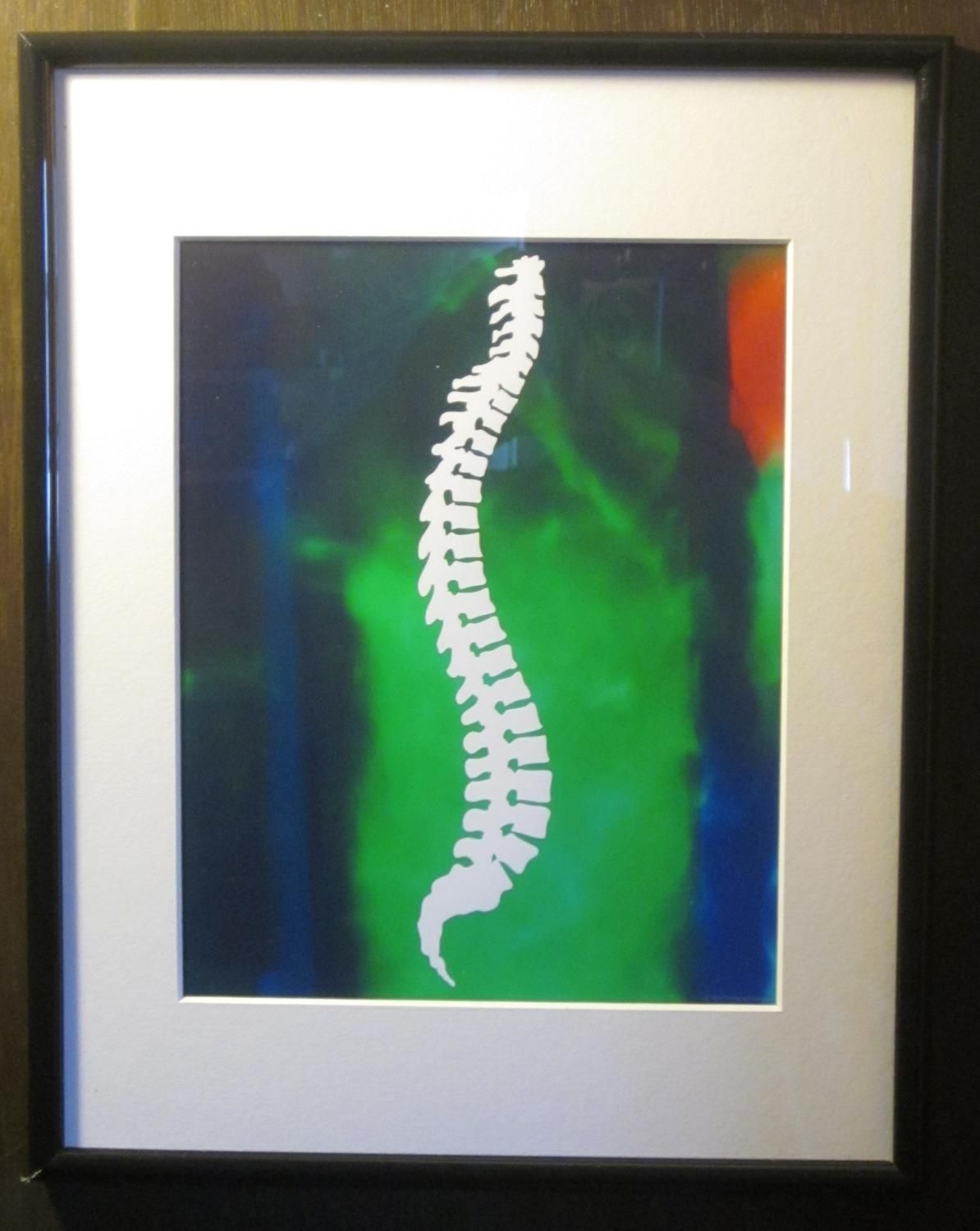 Matted And Framed Chiropractic Spine Silhouette Print Intended For Chiropractic Wall Art (View 14 of 20)